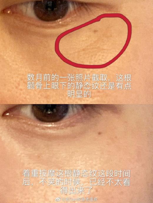 【2.21王炸割肉价】雅萌YAMAN美容仪红光Bloom法令纹神器面部提拉紧致按摩 商品图3