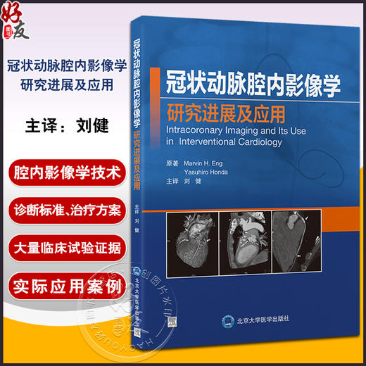 冠状动脉腔内影像学研究进展及应用 刘健 主译 本书涵盖冠状动脉腔内影像学领域主要内容重要进展 北京大学医学出版9787565930614  商品图0