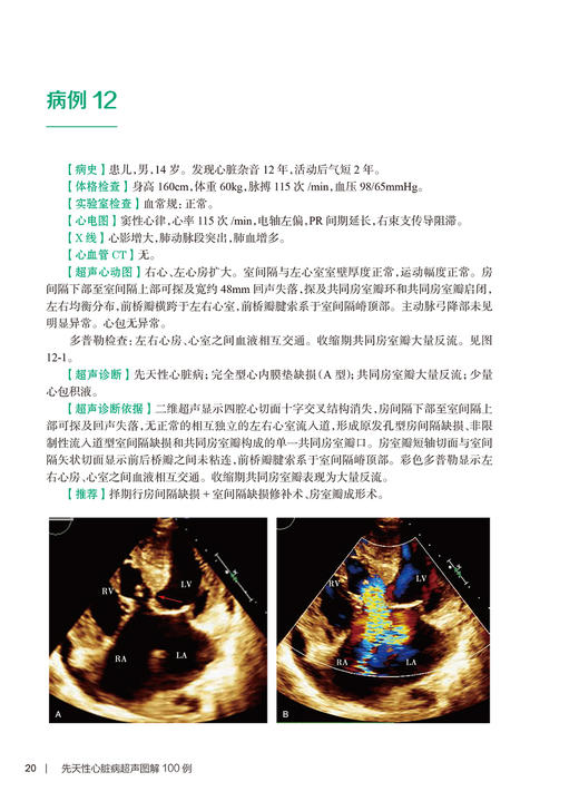 先天性心脏病超声图解100例 住院医师超声医学PBL教学培训系列教程 逄坤静张玉奇临床影像学诊断彩色多普勒3D超声静态图像报告书写 商品图4