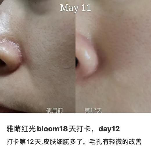 【2.21王炸割肉价】雅萌YAMAN美容仪红光Bloom法令纹神器面部提拉紧致按摩 商品图4