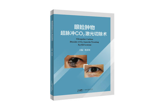 眼睑肿物超脉冲CO2激光切除术 商品图0