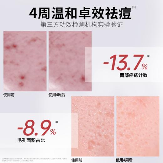 若美欣-（第五代）杏仁酸祛痘嫩肤精华液30ml  【品牌直发】A-1980-240221 商品图1