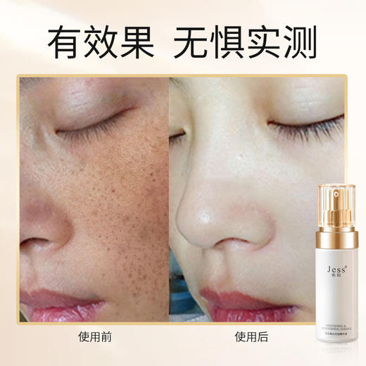 名后美白光绽礼盒 | 精准淡斑，科学美白 商品图3