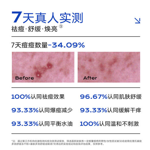 优理氏冻干粉寡肽原液修护去淡化祛痘印痘疤 商品图3