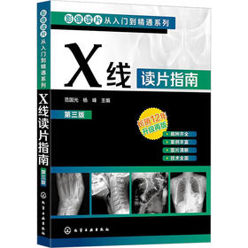 X线读片指南 第3版
