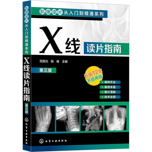 X线读片指南 第3版 商品图0