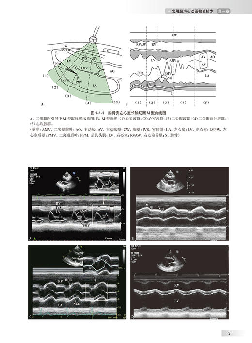 中华心脏超声学 王浩 任卫东 舒先红 主编 心内科学瓣膜病心肌病先心病心脏超声专业参考书疑难病 人民卫生出版社9787117352758 商品图4