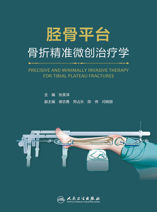 胫骨平台骨折精准微创治疗学 2024年2月参考 商品图1