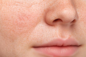 换季皮肤干燥缺水？ 补水不如先补胶原蛋白！