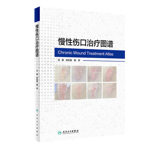 慢性伤口治疗图谱 伤口损伤现状分析理论 处理方法 注意事项 专家评议等方面进行详细的描述 人民卫生出版社9787117357371  商品图1