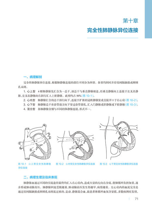 心脏外科监护 徐宏耀 吴信 供心脏外科医师心血管内科医师心脏外科护师及医学院校护师学校学员阅读 人民卫生出版社9787117356725 商品图4