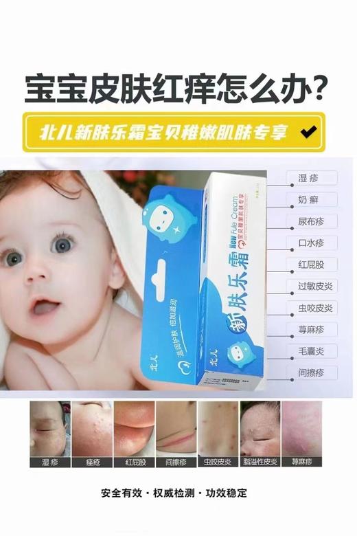 北儿新肤乐霜一支55元 商品图2
