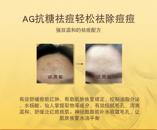 【清仓好价】日本PHZ舒缓祛痘膏24g*2支 含水杨酸 清凉舒缓（效期至25.6） 商品图4