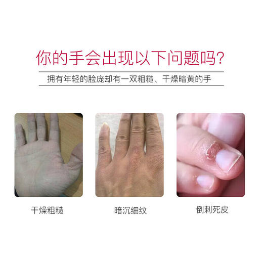 日本本土版 资生堂尿素护手霜红罐秋冬保湿滋润美润 红罐100g一盒装 商品图2