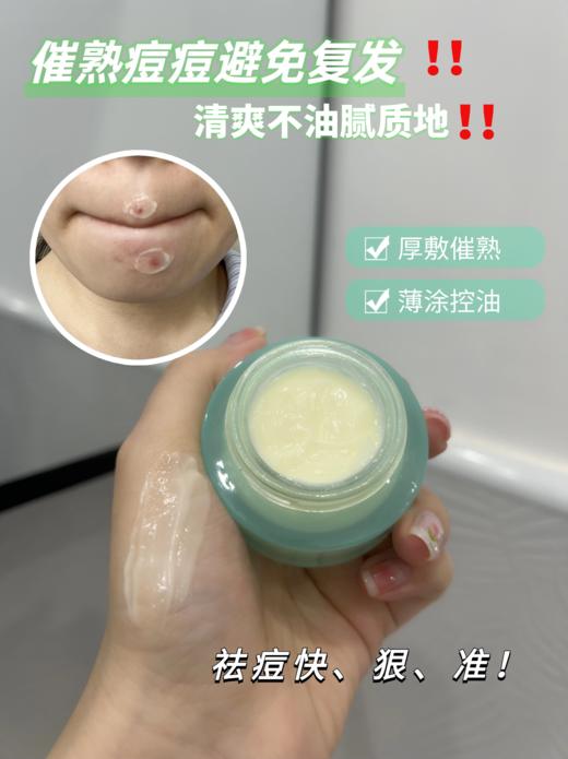 ²【远大净颜水40ml+净颜膏25g组合装】痘痘肌/闭口/毛孔粗大问题肌肤 HM02-CRMM-YD 商品图11