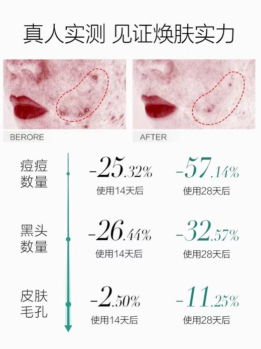 珀莱雅多酸复合焕肤面膜80ml 商品图1