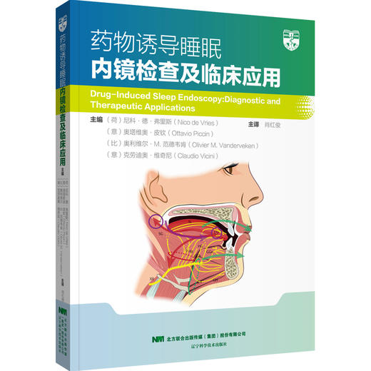药物诱导睡眠内镜检查及临床应用 商品图0