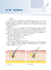 损容性皮肤病影像诊断 刘洁 朱庆莉 皮肤影像学在各种损容性皮肤病病情评估治疗监测等方面的应用 人民卫生出版社9787117352246 商品缩略图3