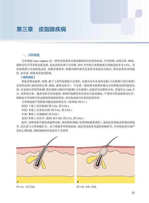 损容性皮肤病影像诊断 刘洁 朱庆莉 皮肤影像学在各种损容性皮肤病病情评估治疗监测等方面的应用 人民卫生出版社9787117352246 商品图3