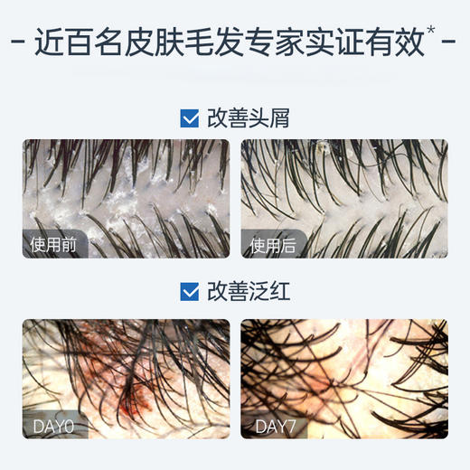 【第二瓶半价】儒意红没药醇洗发水去屑zhi痒控油蓬松洗头膏洗发露女男士专用 商品图4