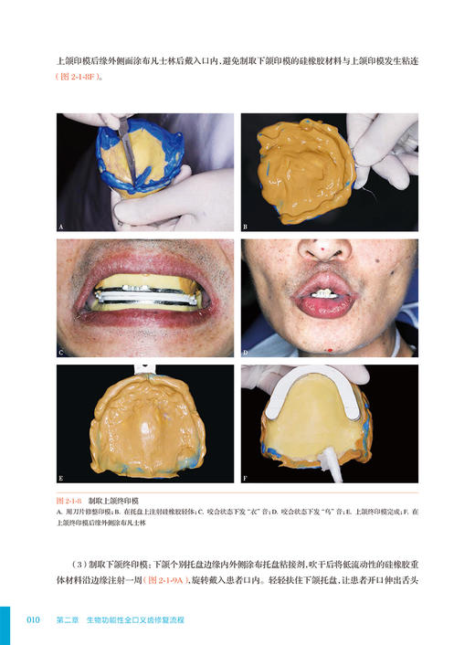 生物功能性全口义齿修复常见问题与解析 吴哲 BPS义齿修复操作流程 临床常见问题分析解决 口腔科学 人民卫生出版社9787117358408 商品图4