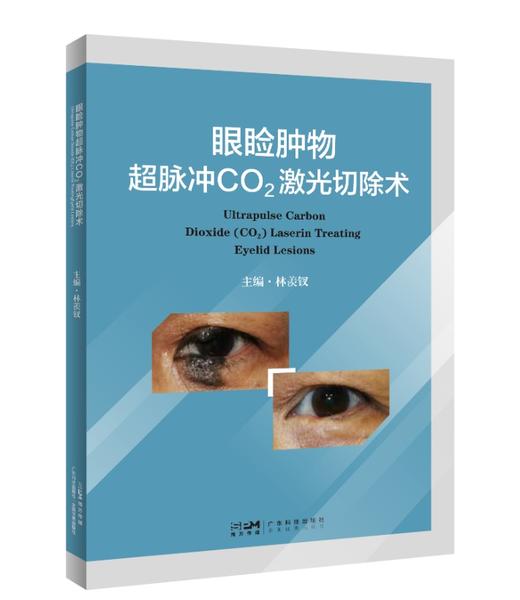 眼睑肿物超脉冲CO2激光切除术 商品图0