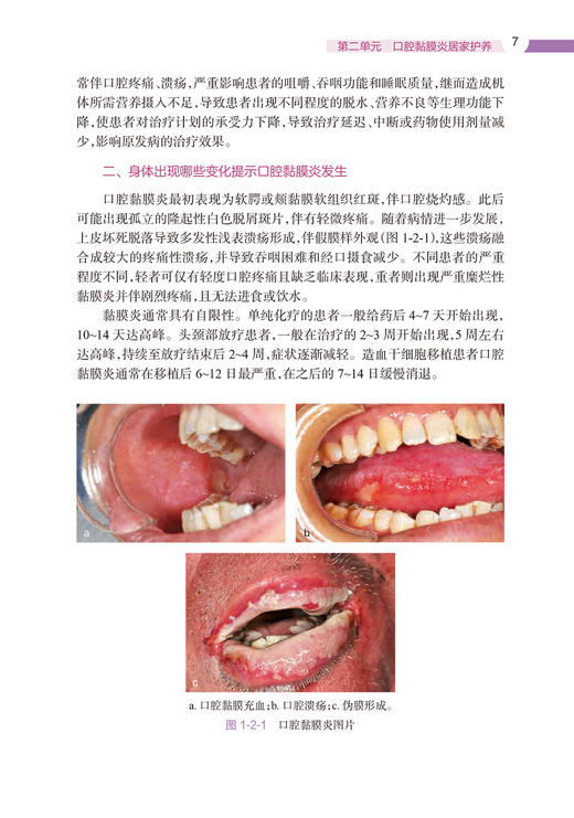 肿瘤患者居家护养 居家护养系列 附视频 张利岩 刘则杨 应岚 肿瘤居家护养知识科普 自我照护方法技能9787117359849人民卫生出版社 商品图4