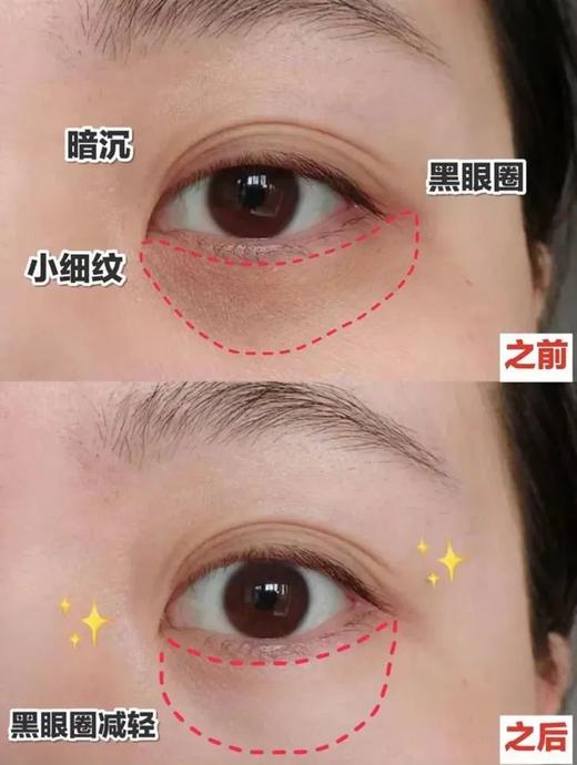 【品牌授权】爆款礼盒 雅诗兰黛新年龙年限定抗蓝光眼霜两件套 15ml*2 七夕情人节礼物 送闺蜜送女友 商品图5