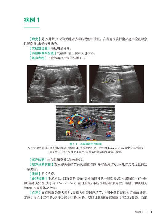 胰腺疾病超声图解100例 吕珂 蒋天安 王晓曼 住院医师超声医学PBL教学培训系列教程 经典疾病图像分析9787117356534人民卫生出版社 商品图3