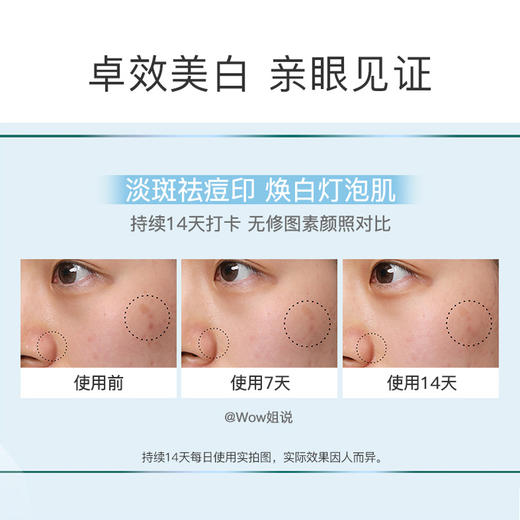 【国内专柜 品牌直发】欧莱雅光子瓶美白淡斑精华小样 商品图3