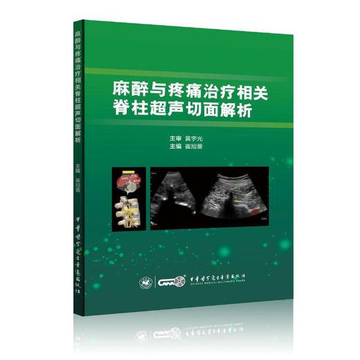 麻醉与疼痛治疗相关脊柱超声切面解析 商品图0