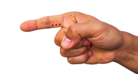  食指有一奇穴，鼻炎、肝火旺、迎风流泪都能解决 