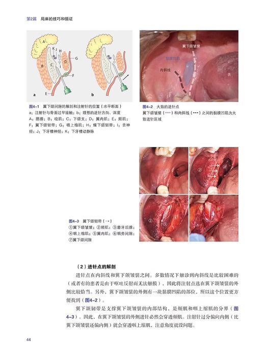 口腔临床麻醉技术与技巧 基于循证和解剖 岩永让等编 牙科学书籍 拔牙麻醉口腔临床医学书籍 辽宁科学技术出版社9787559132246 商品图4