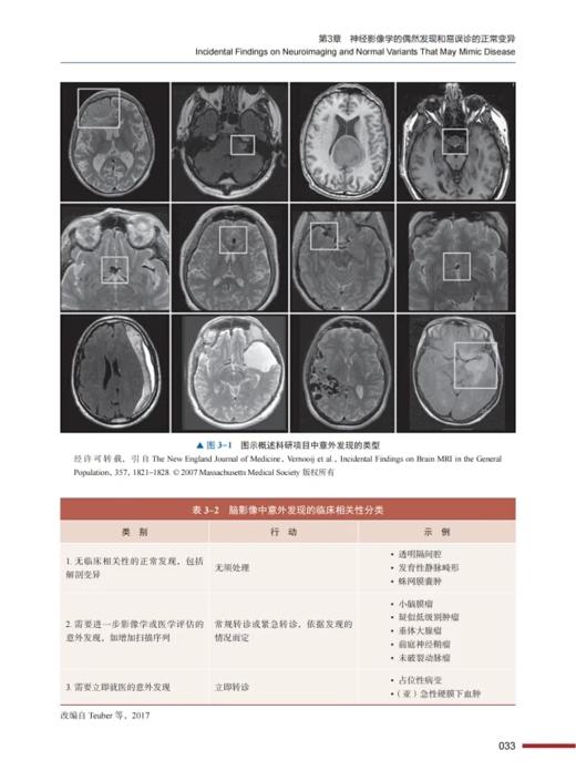 ESNR临床神经放射学 上下全2卷 张龙江 刘亚欧主译 神经系统各类疾病影像学表现临床经典病例 中国科学技术出版社9787523600979 商品图3