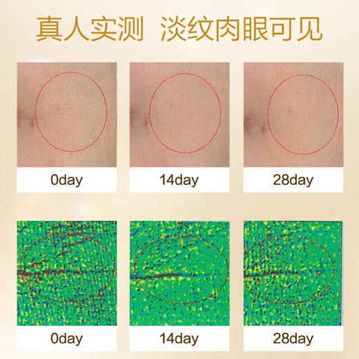 马应龙八宝紧致型&赋能扛皱型眼霜(自营) | 替你赶走 眼纹、黑眼圈，比同龄人年轻！ 商品图8