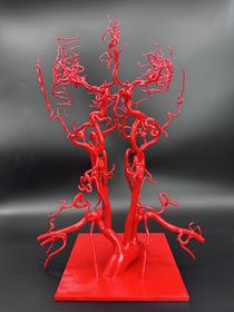 【头颈血管模型】3.0版