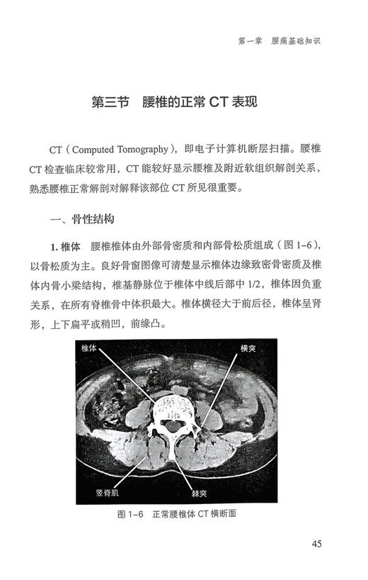 照腰镜 腰痛的诊断与防治 王禹增等编 腰痛基础知识相关骨科内外妇科等疾病临床表现检查特点诊断治疗 中医学 中国中医药出版社 商品图4