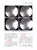 颅神经疾病成本效益评估与管理 汪永新等译 国际经典神经科学译著 颅底解剖临床评估诊断治疗 中国科学技术出版社9787523602508 商品缩略图4