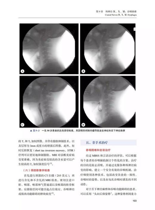 颅神经疾病成本效益评估与管理 汪永新等译 国际经典神经科学译著 颅底解剖临床评估诊断治疗 中国科学技术出版社9787523602508 商品图4