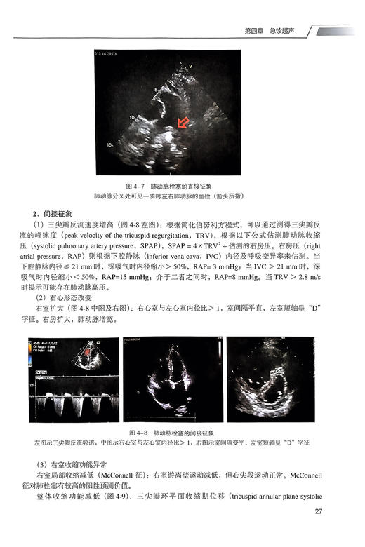 急诊危重病理论与实践 马青变 李姝 北大医学研究生规划教材 急危重症诊断要点治疗原则操作技能 北京大学医学出版社9787565930195 商品图3