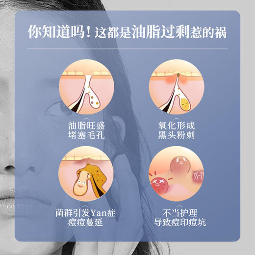 【40年国货品牌】温和不刺激 |片仔癀清痘补水护肤洁面水乳套装 击退油光 商品图4