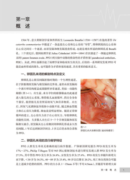 卵圆孔未闭规范化诊疗 从指南到实践 张曹进 胡海波 王琦光 PFO影像学诊断操作步骤 规范化治疗 临床实际案例应用 人民卫生出版社 商品图3