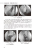 专科技能培训教程 耳鼻咽喉头颈外科学分册 张欣 谭国林 附视频 专科医师规范化培训创新融合教材 人民卫生出版社9787117359214 商品缩略图3
