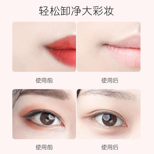 【无需乳化！净透植萃卸妆膏 】4合1卸深层清洁卸妆，温和不刺激敏感肌卸妆油，养出细腻好肌肤QQ 商品图3