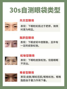 涨知识！改善眼袋竟然这么简单！