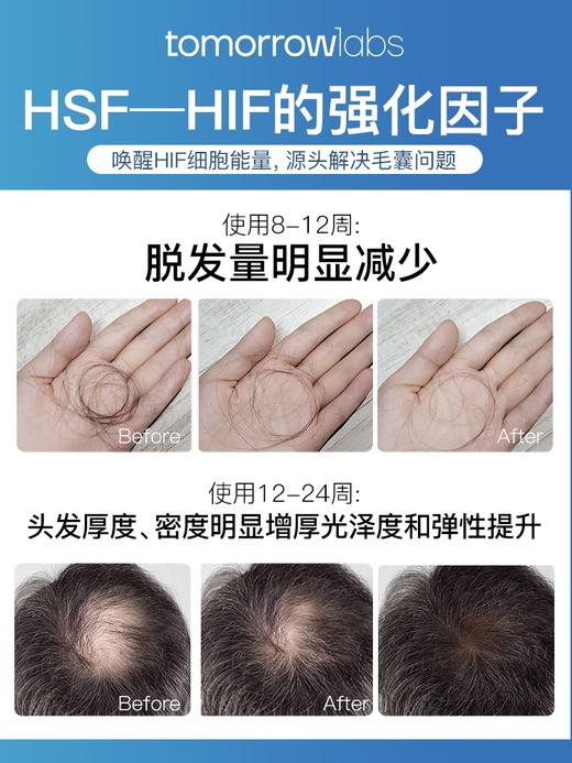 tomorrowlabs头发再生修复液50ml*2育发增发密发精华液头皮滋养 商品图3