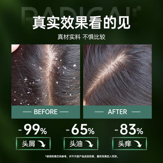 【保税直发】包邮包税  26年9月 波兰Radical去头屑洗发水400ml 商品图3