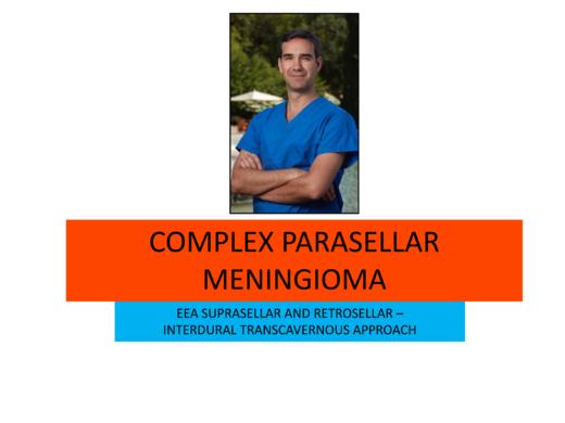 2023Top4. Meningioma 商品图0