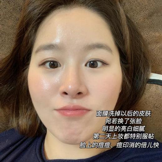 【清仓好价】美迪恩双萃碳酸啫喱面膜100ml(限25年5月左右) 商品图1