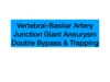 Top1. 椎基底动脉交界处双巨大动脉瘤，Bypass & Trapping 商品缩略图0
